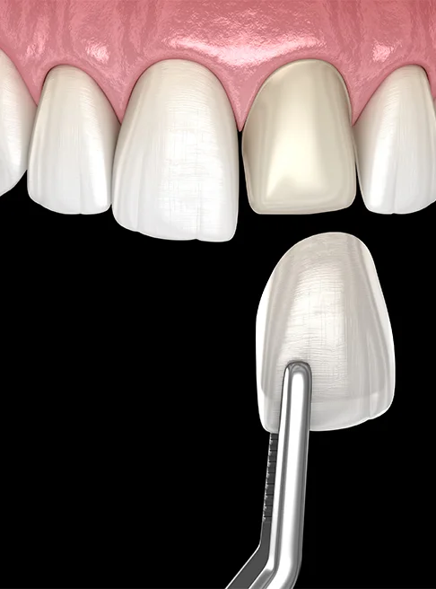 Restorative dentistry | West Village Dental Care | Dearborn, MI 48124